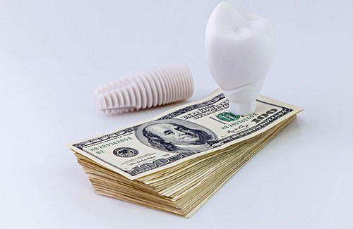 Dental implants on a pile of money