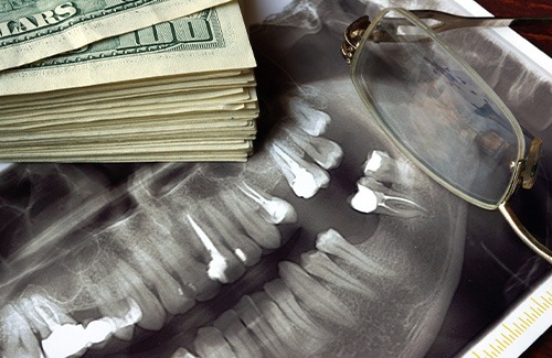 Money on a dental x-ray