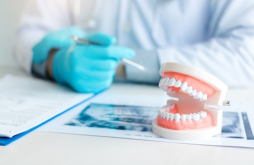 Dentist in blue gloves reviewing x-rays next to false teeth