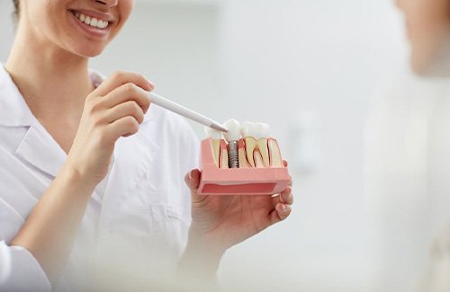 a dentist holding a model of a dental implant