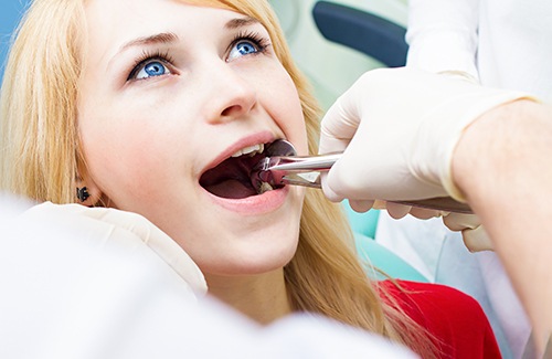 Girl with blue eyes having a tooth extracted with forceps